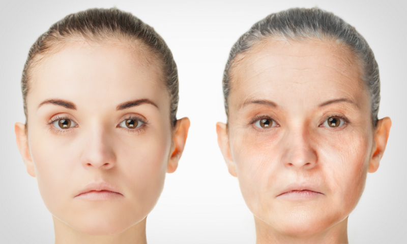 Learn Why a Thread Lift Is Often Called a Non-invasive Facelift