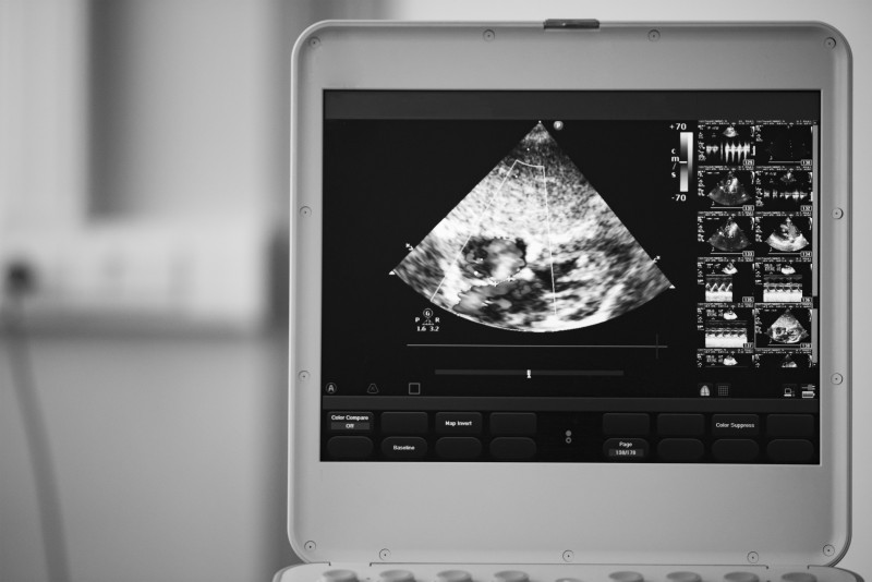 Understanding Ultrasound and Its Many Uses in the Medical Field